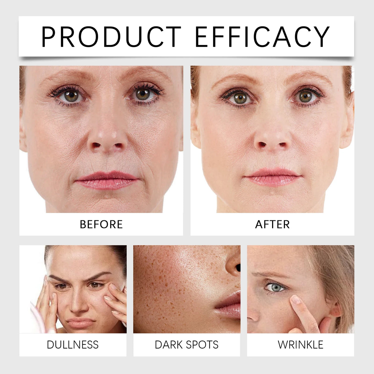 Sérum Facial Centella Asiática HOYGI