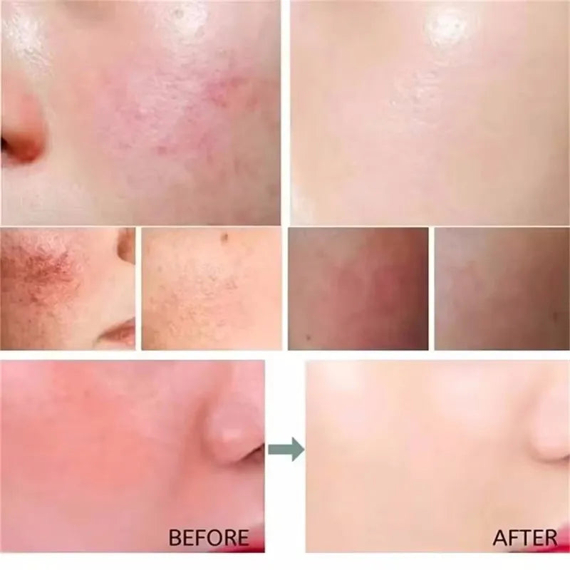 Sérum Facial Calmante e Hidratante